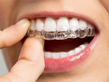 Diş Gıcırdatma Tedavi Yöntemleri