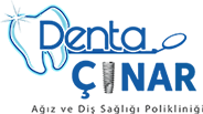dentacinar Logo
